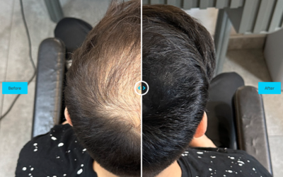Say Goodbye to Sparse Hair with Batci Hair Concealer